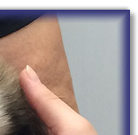 Bertie's BAER hearing test at 5 weeks